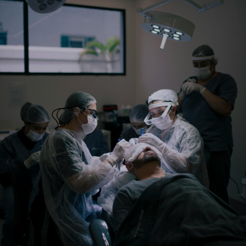 Temple Hair Transplant at HairSense Navi Mumbai
